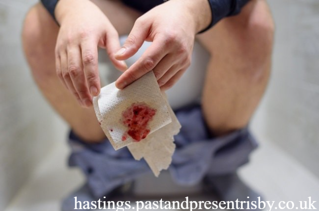 Cara Ampuh Mengatasi BAB Berdarah Tanpa Panik